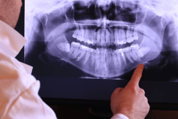 Trusted CA Emergency Dental Service Experts